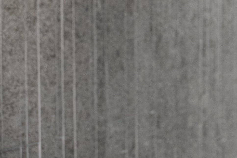 청담동 임플란트 불편함을 줄인 방법 관련 이미지 15