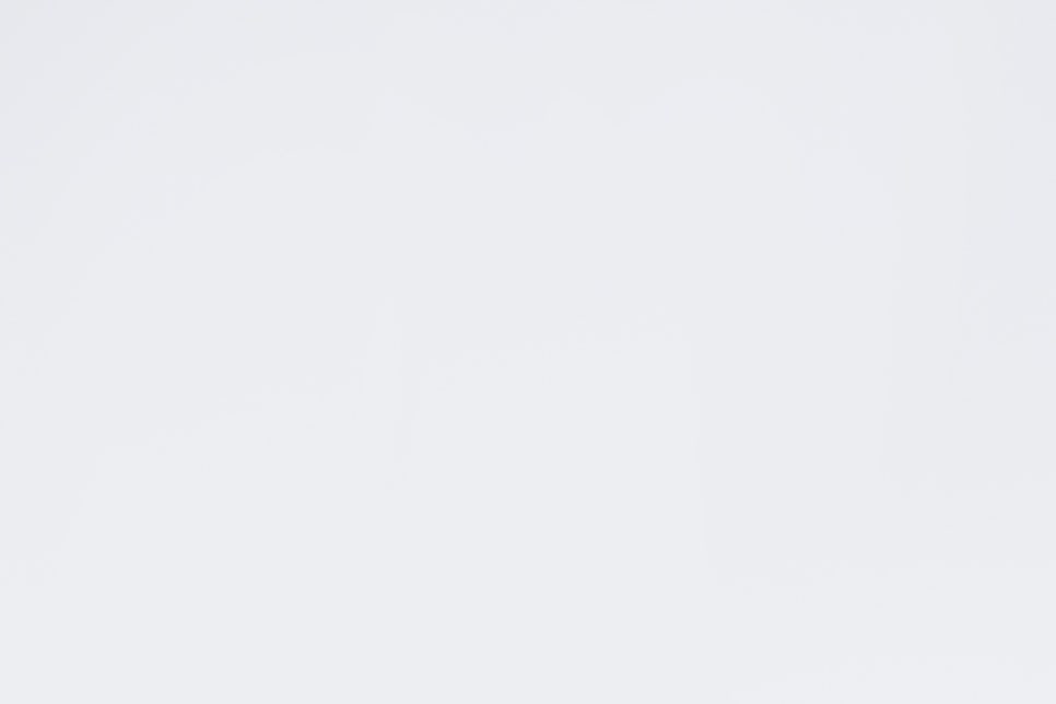 강남 20대임플란트 젊다고 방치는 금지 관련 이미지 18