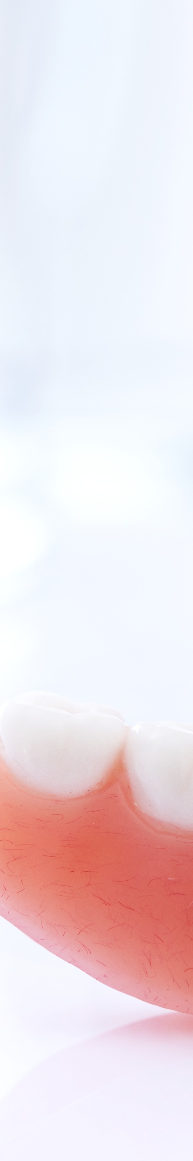 라미네이트 빠짐 이런 경우에 어떻게 해야 할까 관련 이미지 30