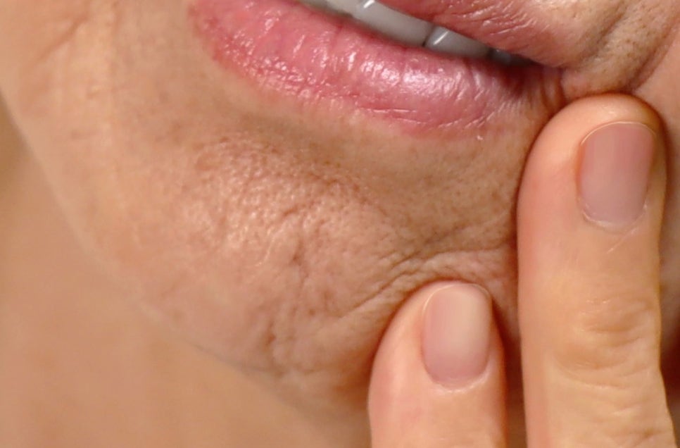 강남 어금니 임플란트 고려가 필요한 4가지! 관련 이미지 22