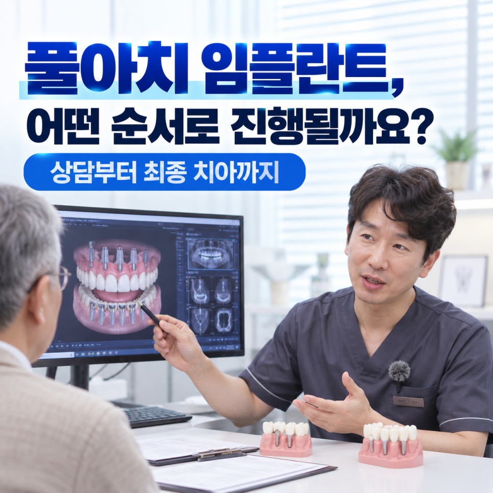 풀아치 임플란트, 어떤 순서로 진행될까요? 자주 묻는 질문 관련 이미지 3