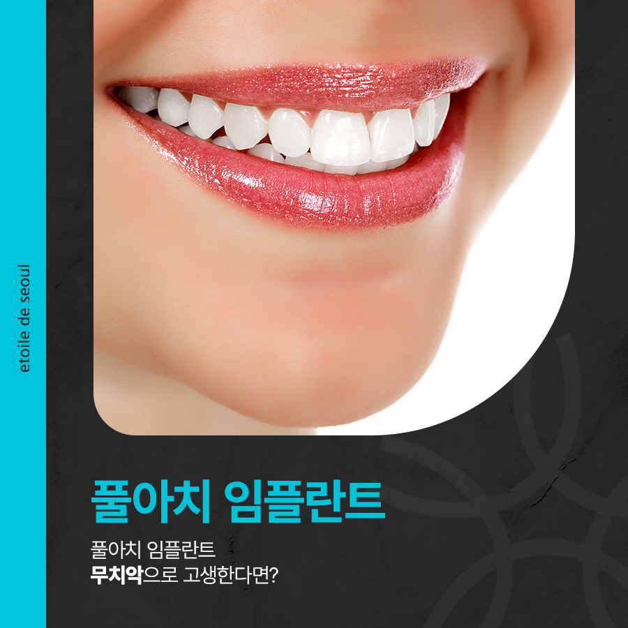 풀아치 임플란트 무치악으로 고생한다면? 관련 이미지 1