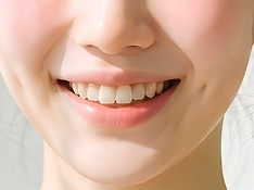 4 Reasons Why the Cost of No-Prep Veneers in Gangnam Varies image 6