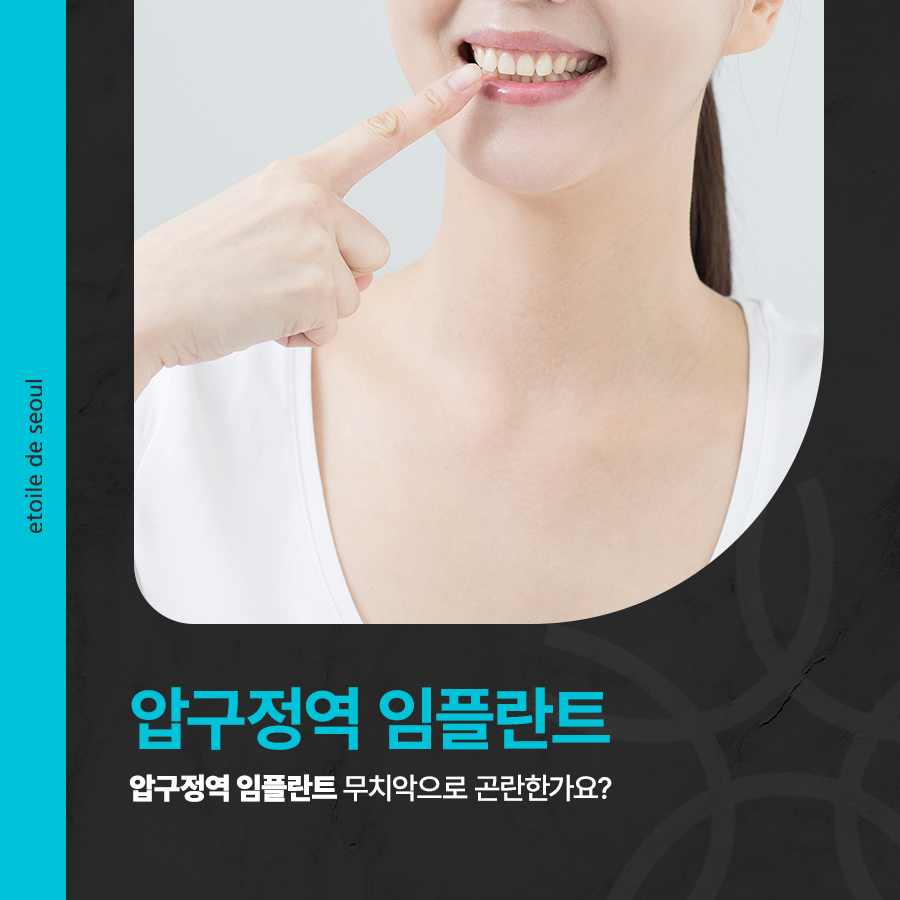 압구정역 임플란트 무치악으로 곤란한가요? 관련 이미지 1