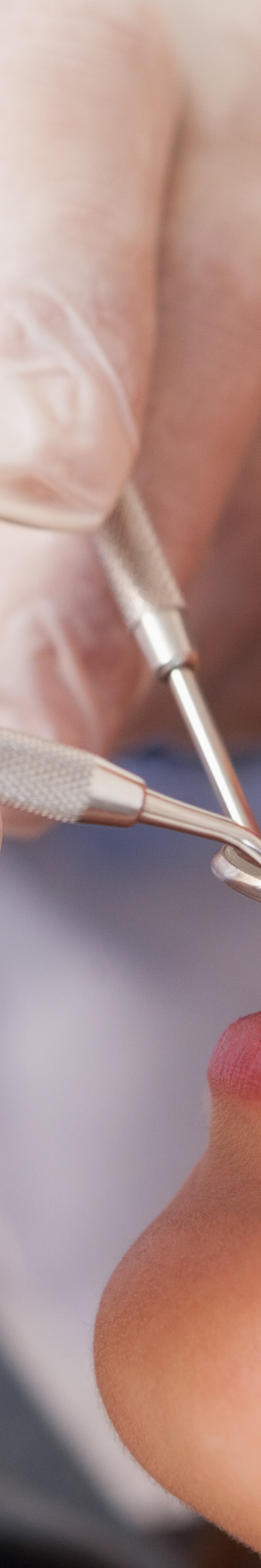 최소 삭제 라미네이트 치아를 지키며 아름다움 더하기 관련 이미지 28