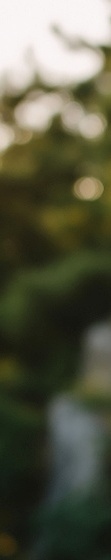 압구정치과 전악 임플란트 가격 비교와 진행 과정 관련 이미지 23