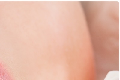 청담동치과 추천 앞니가 부러졌어요! 관련 이미지 12