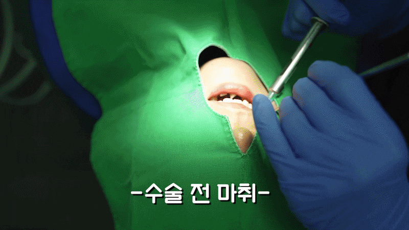 무치악 틀니 대신 가능한 풀아치 임플란트 관련 이미지 11