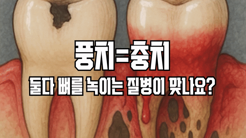 풍치 예방 방법 건강한 잇몸을 지키는 것 관련 이미지 3