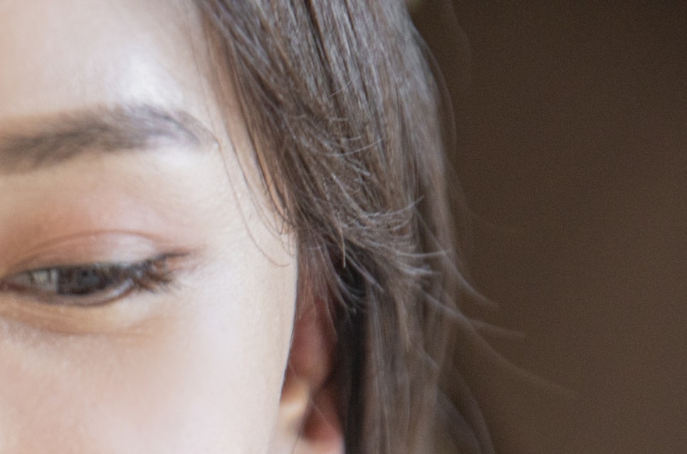 강남 20대임플란트 젊다고 방치는 금지 관련 이미지 11