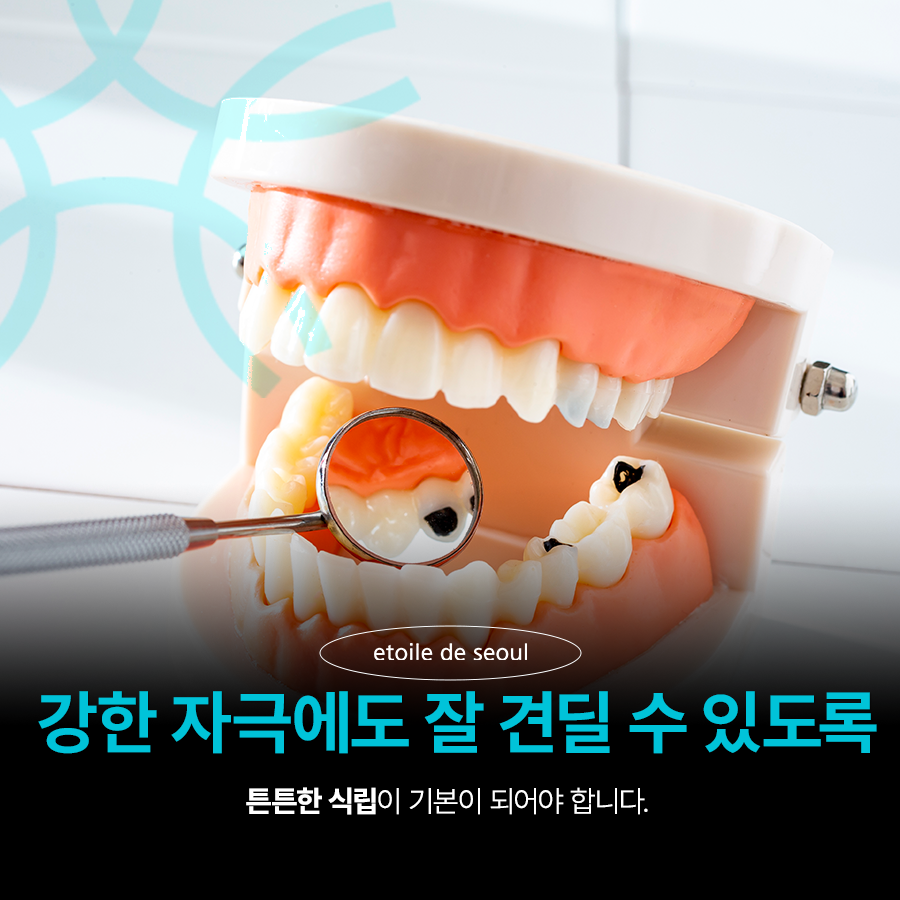 강남 어금니 임플란트 고려가 필요한 4가지! 관련 이미지 3