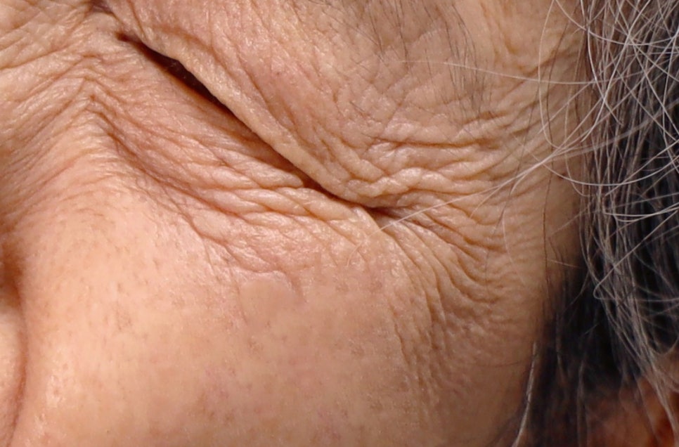 강남 어금니 임플란트 고려가 필요한 4가지! 관련 이미지 20