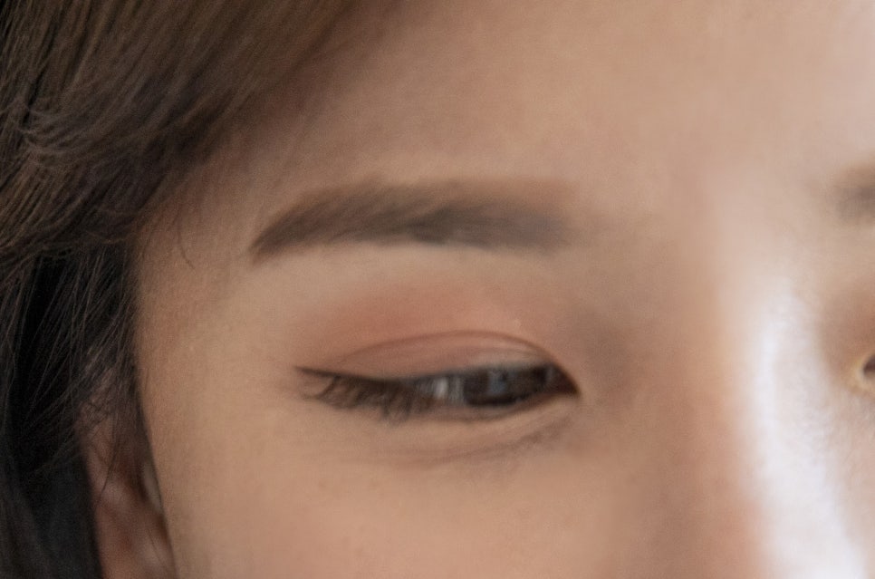 강남 20대임플란트 젊다고 방치는 금지 관련 이미지 10