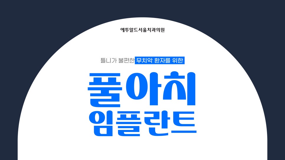 디지털 풀아치 임플란트 정말 두달이면 다 끝나나요? 관련 이미지 1