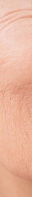 Wondering How Long Full-Arch Implant Surgery Takes? image 36