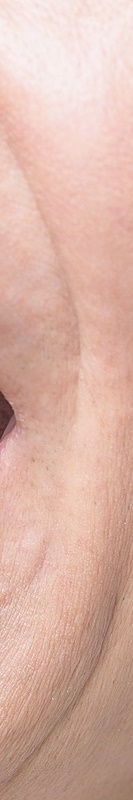 압구정치과 풀아치임플란트 회복기간 얼마나 필요할까 관련 이미지 38