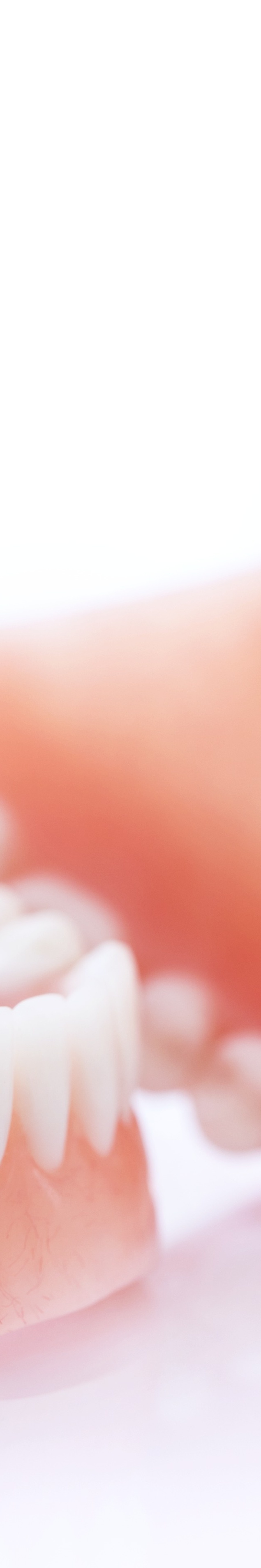 라미네이트 빠짐 이런 경우에 어떻게 해야 할까 관련 이미지 33