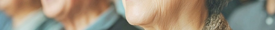 풀아치임플란트보증기간 노본아치는 다릅니다 관련 이미지 27