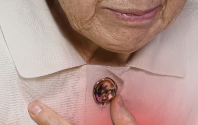 심장이빨리뛸때 대처법 긴급이라면? 관련 이미지 9