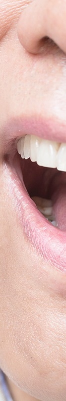 압구정치과 풀아치임플란트 회복기간 얼마나 필요할까 관련 이미지 35