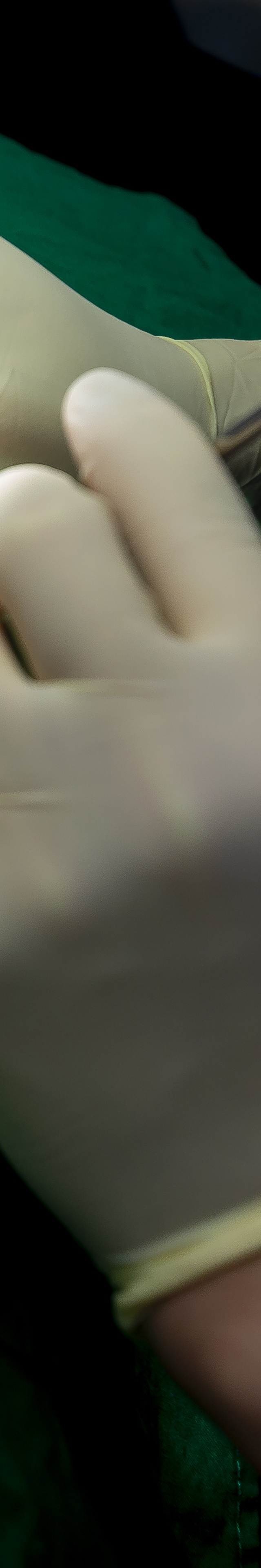 아랫니 라미네이트 숨겨왔던 미소를 되찾는 여정 관련 이미지 20