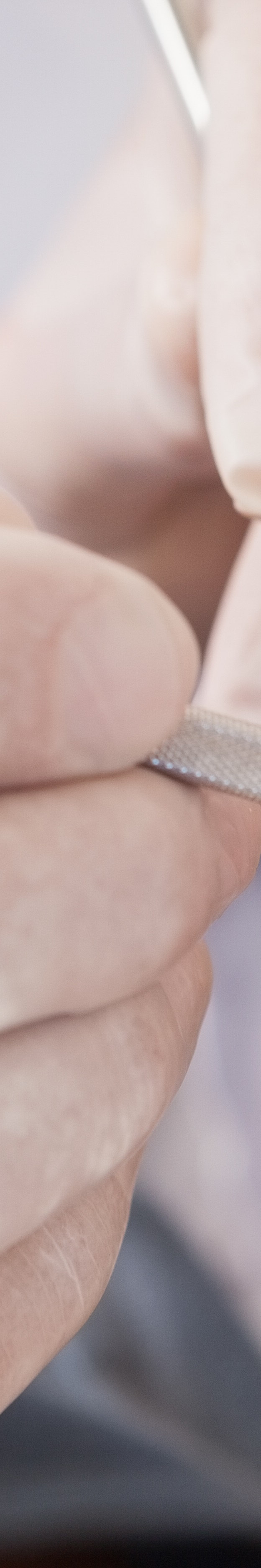 최소 삭제 라미네이트 치아를 지키며 아름다움 더하기 관련 이미지 27