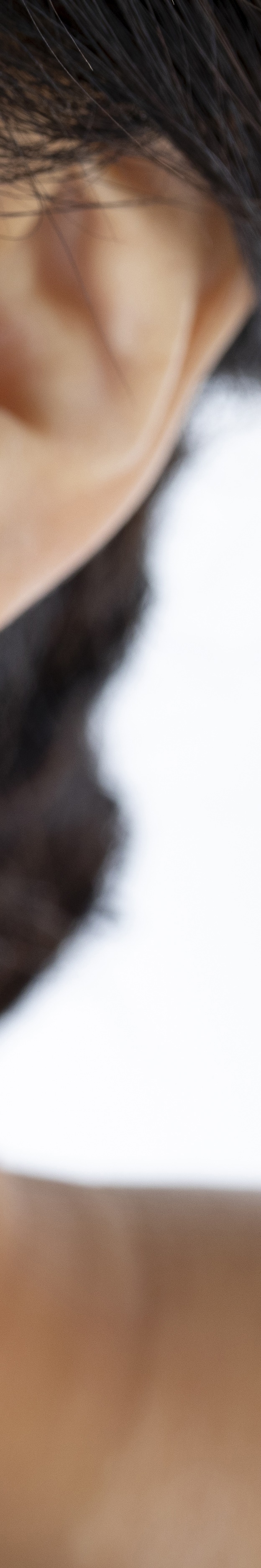 앞니임플란트잘하는곳 당신의 웃음을 찾아드립니다 관련 이미지 31