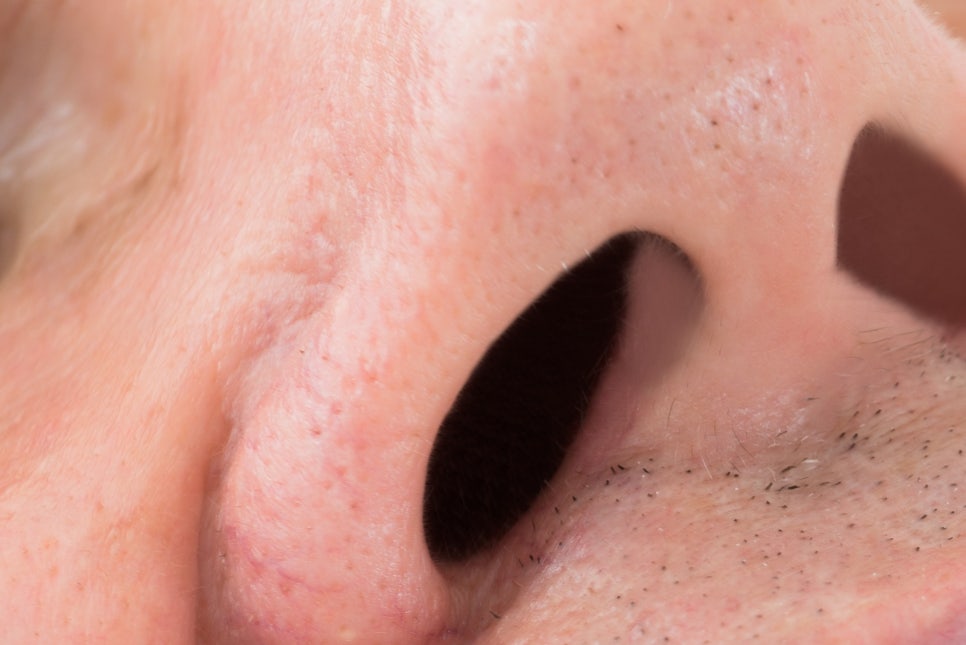 강남 노인임플란트 삶의 질이 달라져요 관련 이미지 9