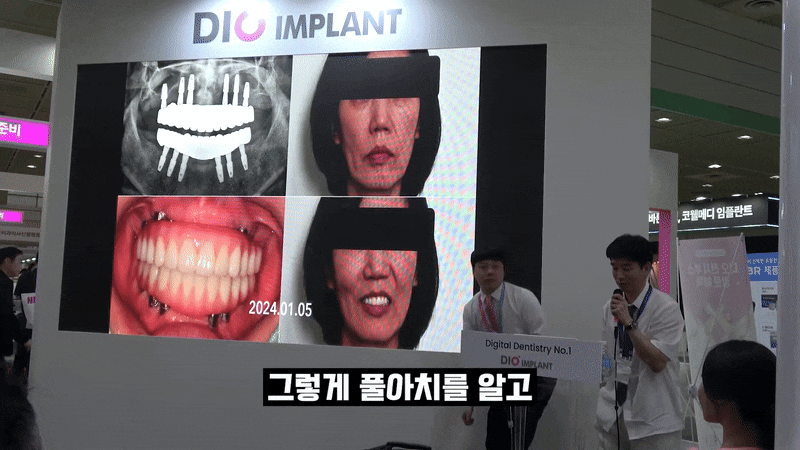 강남 임플란트치과추천 찾아보고있다면 관련 이미지 8