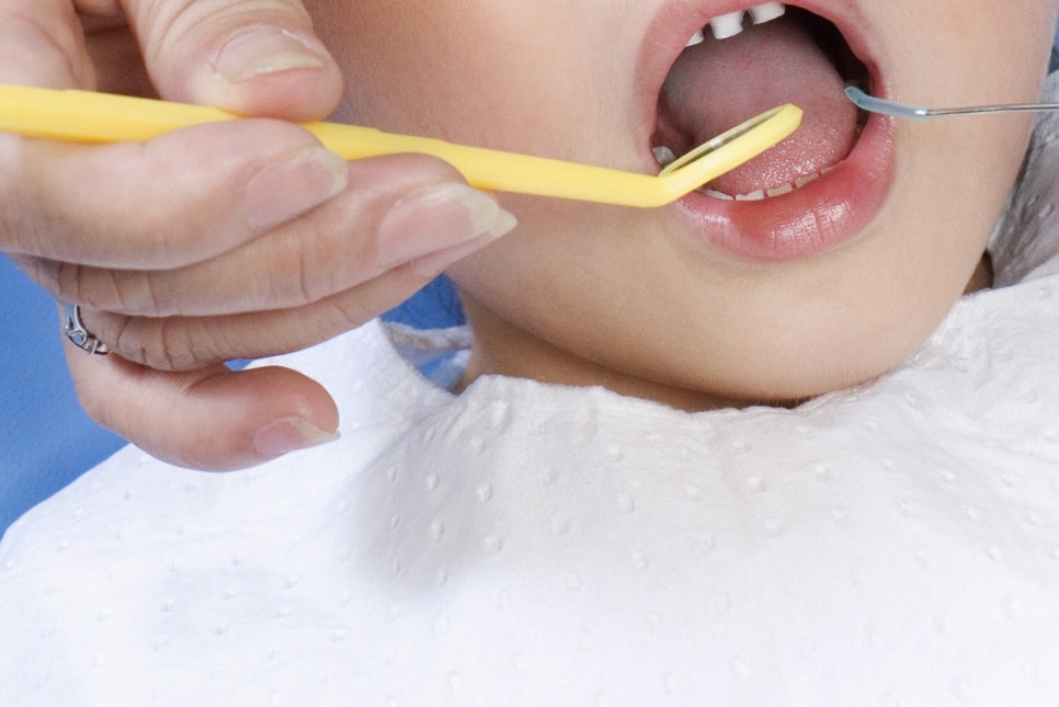 풀아치임플란트 불편한 틀니와 작별해요! 관련 이미지 25