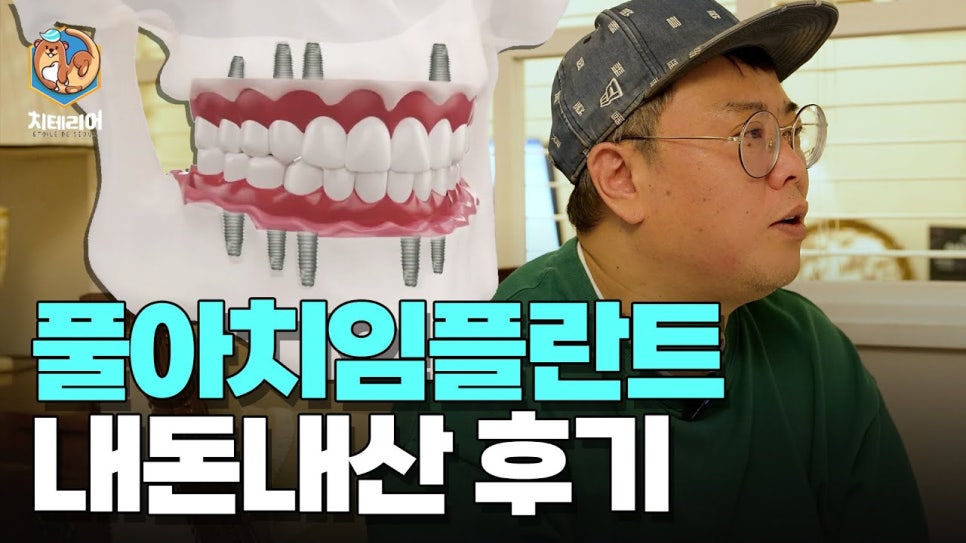 풀아치임플란트후기 결정 전 확인해야할 사항 관련 이미지 6