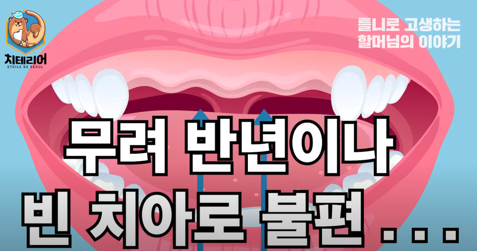 풀아치임플란트 정품 치과를 확인해야해요! 임플란트 하실 분 주목!! 관련 이미지 2