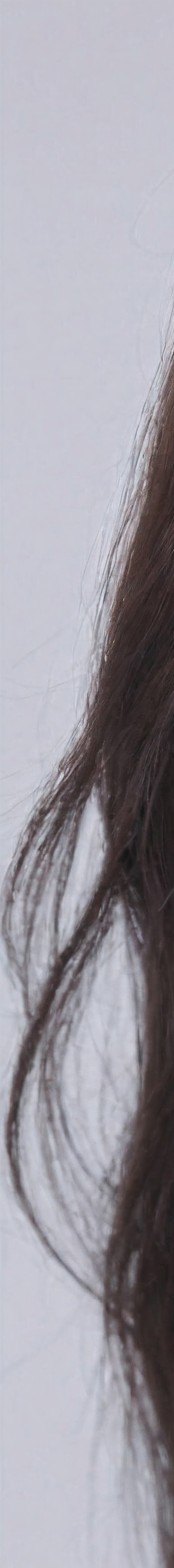 앞니올세라믹 숨겨왔던 미소를 되찾다 관련 이미지 23