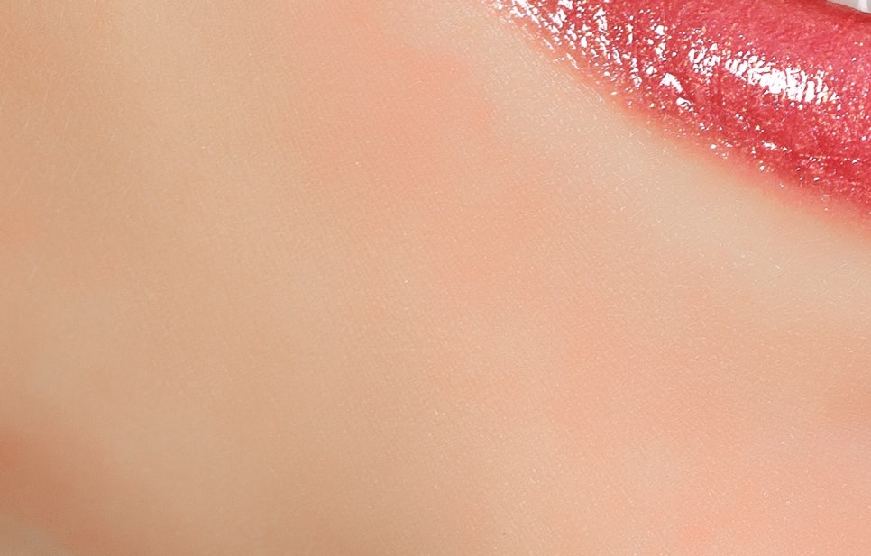 풀아치 임플란트 무치악으로 고생한다면? 관련 이미지 21