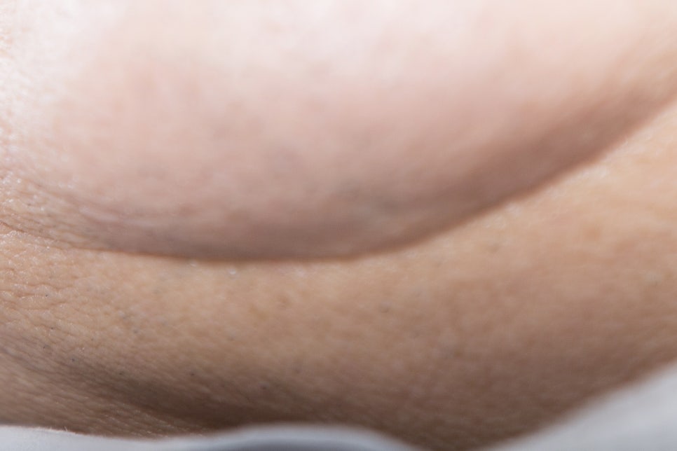 청담동 임플란트 불편함을 줄인 방법 관련 이미지 25