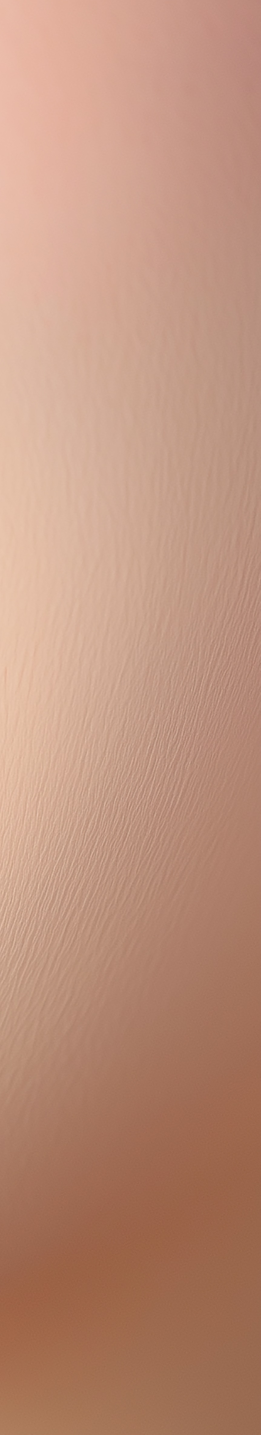 서울무삭제라미네이트 치아 본연의 아름다움을 지키다 관련 이미지 22