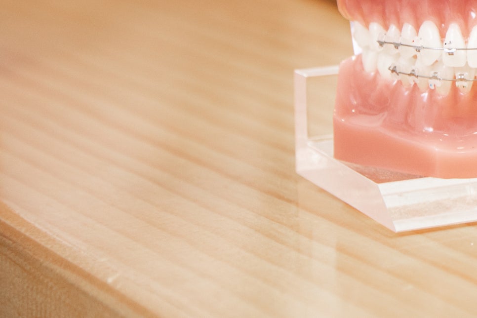 풀아치임플란트 잘하는곳 다수 식립 비용이 부담이라면 관련 이미지 25