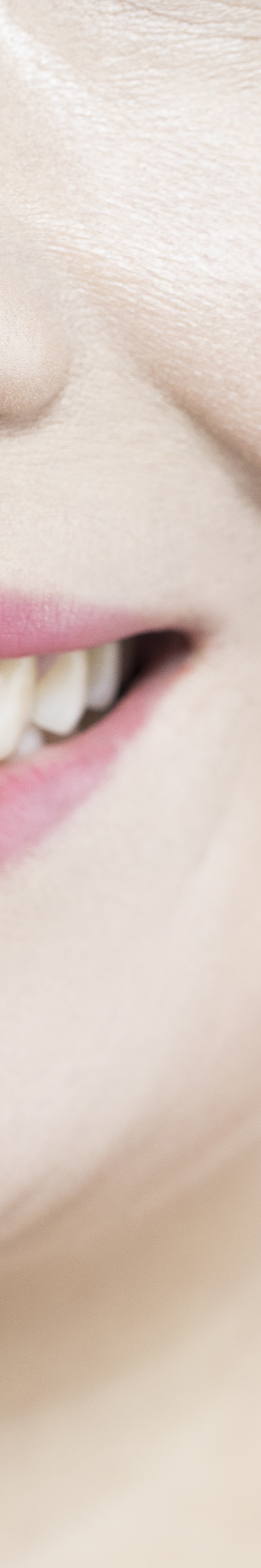 라미네이트 재시술 완벽한 미소를 위한 두 번째 여정 관련 이미지 28