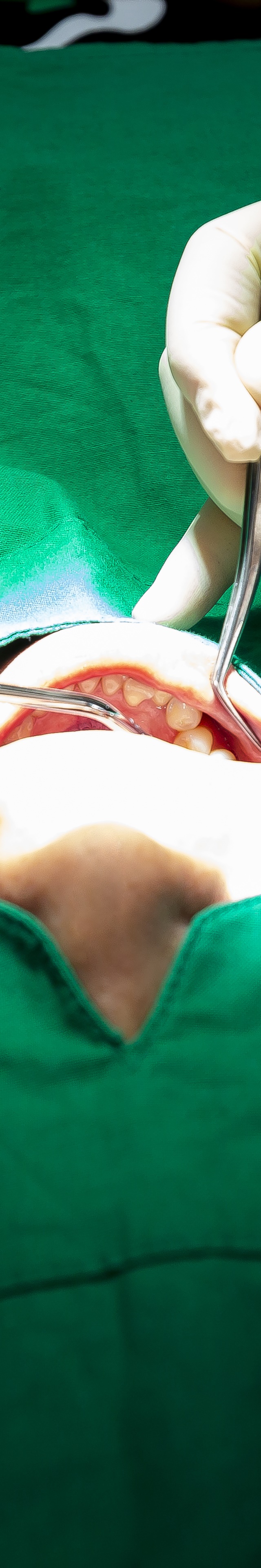 아랫니 라미네이트 숨겨왔던 미소를 되찾는 여정 관련 이미지 18