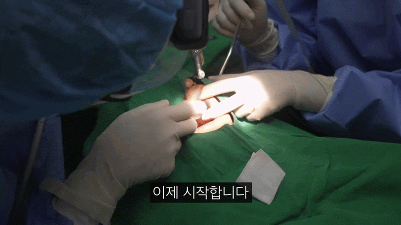 풀아치 임플란트 통증 걱정 때문에 망설이셨다면 치료 전에 알아야 할 5가지 관련 이미지 6