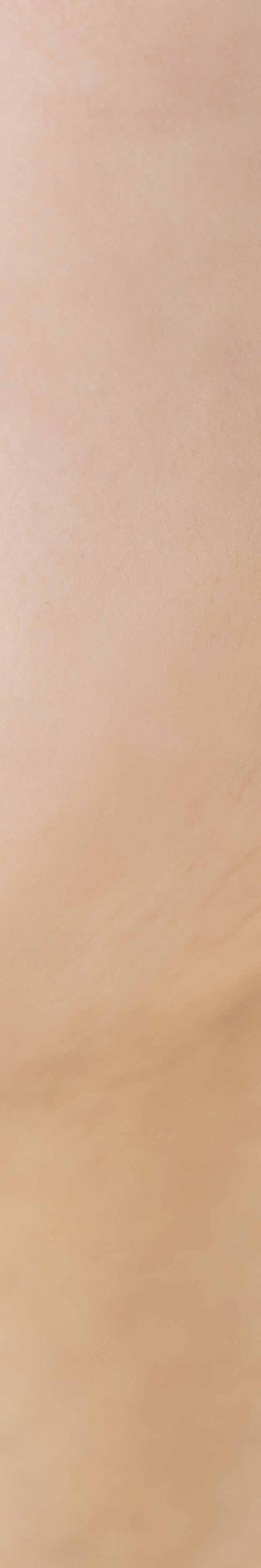 앞니임플란트잘하는곳 당신의 웃음을 찾아드립니다 관련 이미지 28