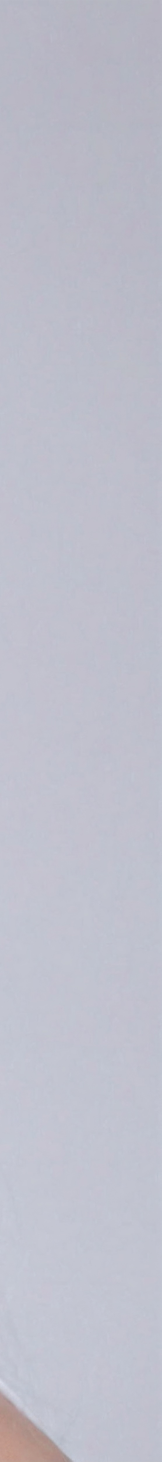 압구정라미네이트 인상을 바꾸는 방법 관련 이미지 23