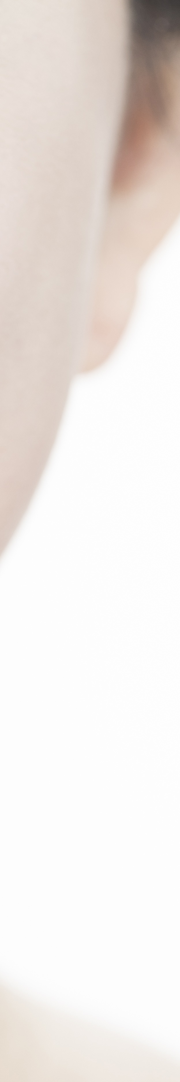 라미네이트 재시술 완벽한 미소를 위한 두 번째 여정 관련 이미지 30