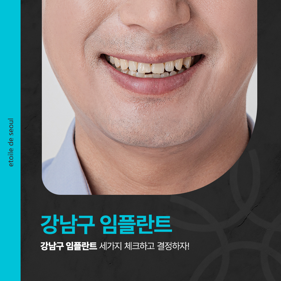 강남구 임플란트 세 가지 체크하고 결정하자! 관련 이미지 1
