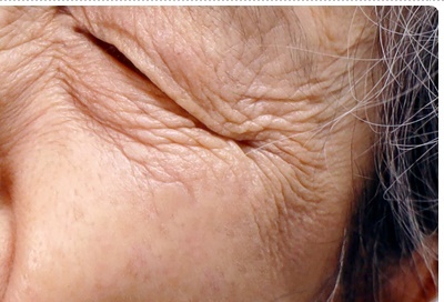 압구정로데오 임플란트 탄탄한 치아 유지는? 관련 이미지 11