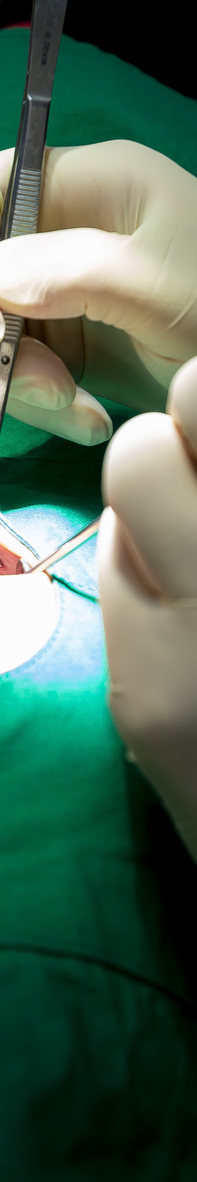 아랫니 라미네이트 숨겨왔던 미소를 되찾는 여정 관련 이미지 19