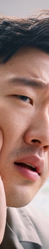 Front Tooth Implant Temporary Tooth: It Is Definitely Necessary image 27