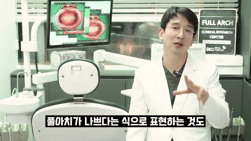 국산 임플란트 종류 가격과 특징 비교하기 관련 이미지 4