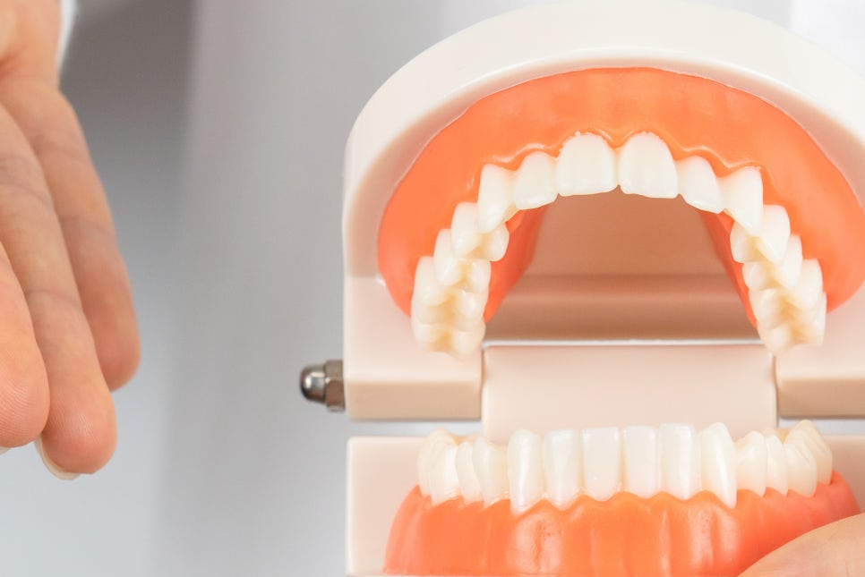 청담역 임플란트 치아 상실 극복을 바라며 관련 이미지 22