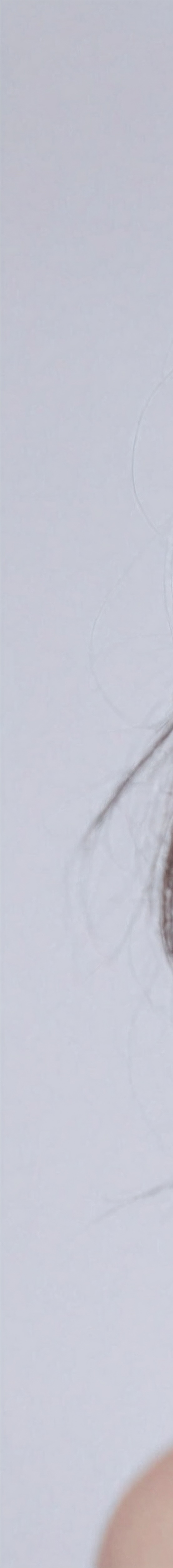 압구정라미네이트 인상을 바꾸는 방법 관련 이미지 15